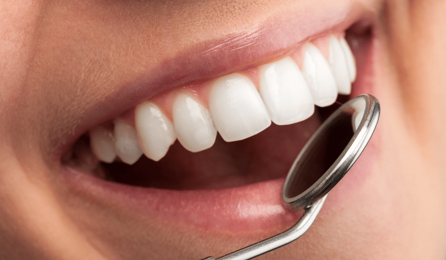 Gingivitis: Causes, Symptoms, And Treatment