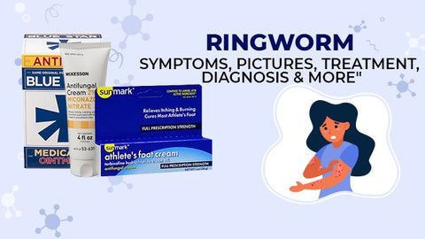Ringworm: Symptoms, Pictures, Treatment, Diagnosis & More