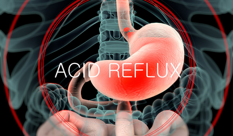 HerbsPro.com | Symptoms of Acid Reflux