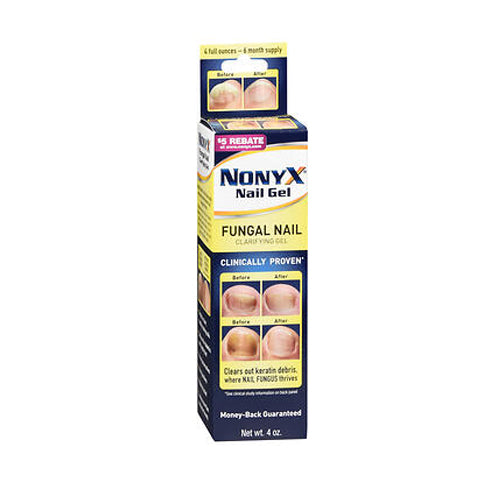 Xenna Nonyx Nail Gel Count of 1 By Xenna